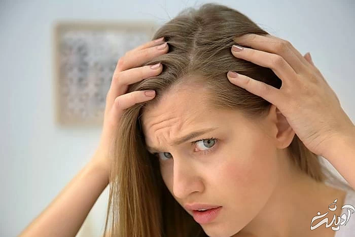 فواید زینک برای موها ریزش مو